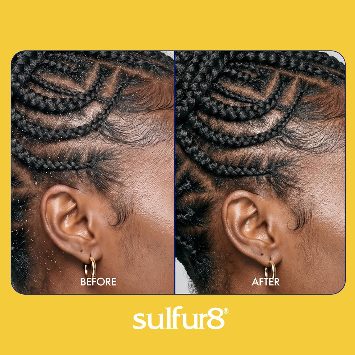 Sulfur8 Dandruff Treatment For Braids 12 oz. Spray by Sulfur 8